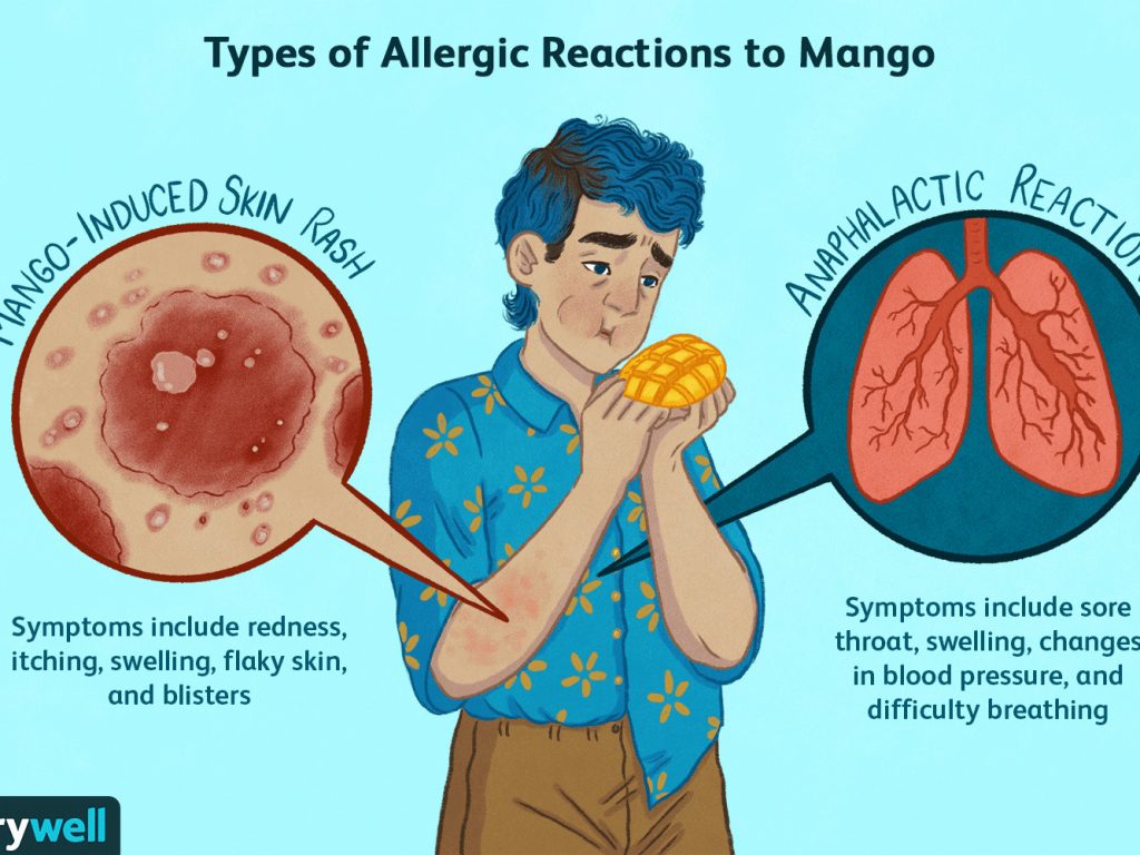 mango-allergy